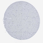 Tissue expression of ILDR2 - Staining in caudate - The Human Protein Atlas