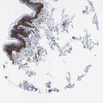 Tissue expression of CAV2 - Staining in skin - The Human Protein Atlas