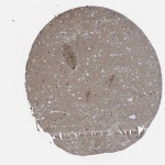 Brain tissue expression of MAPRE2 in basal ganglia - The Human Protein Atlas
