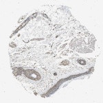 Tissue expression of RBM25 - Staining in skin - The Human Protein Atlas