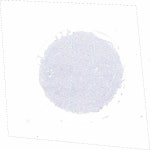 Tissue expression of KRT19 - Staining in caudate - The Human Protein Atlas