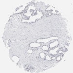 Tissue expression of OGFOD1 - Staining in prostate - The Human Protein Atlas