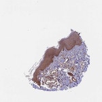 Tissue expression of SETD6 - Staining in skin 1 - The Human Protein Atlas