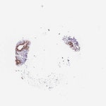 Tissue expression of BRD4 - Staining in breast - The Human Protein Atlas
