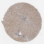 Tissue expression of EVI2B - Staining in liver - The Human Protein Atlas