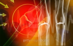 Human leg bone 이미지 (94685335) - 게티이미지뱅크 Human leg bone