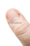 hang nail. 이미지 (173698474) - 게티이미지뱅크 hang nail.