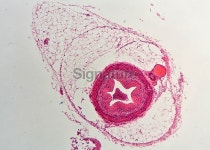 Dog ureter 이미지 (182251841) - 게티이미지뱅크 Dog ureter