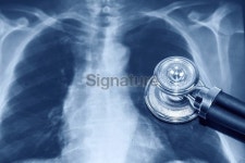 stethoscope and medical x-ray 이미지 (468305429) - 게티이미지뱅크 stethoscope and medical x-ray