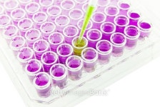 pipette test sample 이미지 (495201432) - 게티이미지뱅크 pipette test sample