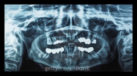 Medical Xray 이미지 (476697162) - 게티이미지뱅크 Medical Xray