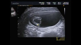 15주2일 제눈엔 삼각점이보이는데 딸같데용ㅋ