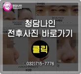 부천쌍꺼풀 완전 마음에 들게하는 청담나인~
