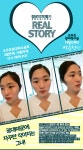 광대축소술 후기 리얼스토리 ~~ 예뻐졌어요^^