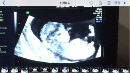 성별문의요~ 무플시러요옹