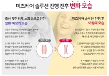 미즈케어솔루션가격 거품빼는방법!