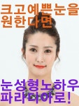 부산눈성형 예쁨의 시작 파라디아에서