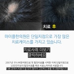 부산탈모 마이플한의원에서 탈모치료 시작하세요