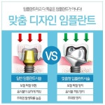 평택치과 조기치료가 답이다