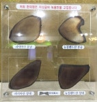 구미성조숙증 우리아이 현재상태를 고려해보세요