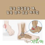 발목 접질렸을 때, 발목 염좌 응급 처치법