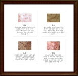 구미여드름 여드름에서 벗어나 변화하는 내 피부!