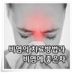 비염치료방법, 환절기엔 이렇게 해보세요~
