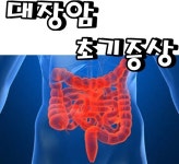 대장암 초기증상 알아보고 예방해요