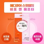 [wshop] 메디큐어 스팟패치 비포앤에프터 69매 여드름 패치 2082336 | 홈쇼핑모아 [wshop] 메디큐어 스팟패치 비포앤에프터 69매... 