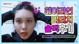 헤어라인반영구 리터치로 더 완벽해진 라인!😍ㅣ비앤미 헤어라인반영구 - kakaoTV 헤어라인반영구 리터치로 더 완벽해진 라인!😍ㅣ비앤미... 