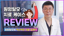 제 35강 #원형탈모 치료 케이스 리뷰ㅣ로하스 의원의... - kakaoTV 제 35강 #원형탈모 치료 케이스 리뷰ㅣ로하스 의원의 #비수술적탈모치료... 