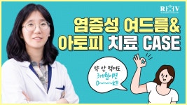 광주여드름 & 아토피치료 - 약 안 먹어도 3개월이면 OK! ( 광주 청담리브의원 조문주원장 CASE ) - kakaoTV 광주여드름 & 아토피치료 -  약 안... 