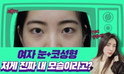 눈성형+코성형 동시에 잘하는 코웰 :) #shorts 코웰성형외과 - kakaoTV 눈성형+코성형 동시에 잘하는 코웰 :) #shorts 코웰성형외과