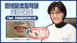 【만 9살 초등학생 - 남자 어린이 투명교정】 인비절라인퍼스트 사례 소개 - 강남 오리건치과 - kakaoTV 【만 9살 초등학생 - 남자 어린이... 