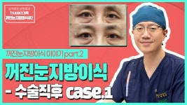 꺼진눈지방이식 - 수술 전후 case.1 50대 남성 (용산역 모차르트성형외과) - kakaoTV 꺼진눈지방이식 - 수술 전후 case.1 50대 남성 (용산역... 