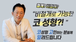 비절개코성형｜청담별의원 - kakaoTV 비절개로 코 성형 할 수 있다 vs 없다｜#04 비절개코성형｜청담별의원