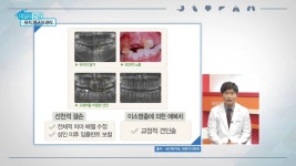 제주도치아교정, 교정치과인 그랜드치과 안주현 원장이 말하는 유치와 영구치의 관리 중요성 / 방송 출연 영상 - kakaoTV 제주도치아교정... 