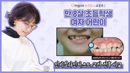 만 8세 초등학생 유치→영구치 단계 어린이 투명교정[인비절라인퍼스트]사례│강남교정치과 - 오리건치과 - kakaoTV 만 8세 초등학생 유치... 