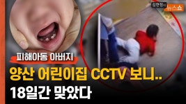 양산 어린이집 학대피해아동 아버지 CCTV 열어보니...18일간 맞았다” - kakaoTV 양산 어린이집 학대피해아동 아버지 CCTV 열어보니...... 