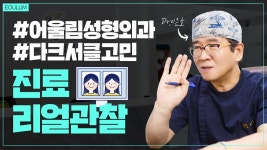 대전눈밑지방재배치 다크서클 해결!? - 대전 어울림성형외과 - kakaoTV 대전눈밑지방재배치 다크서클 해결!? - 대전 어울림성형외과
