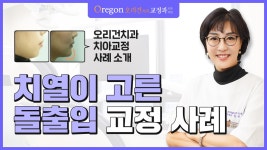치열이 고른 돌출입 교정 사례 소개 [강남교정잘하는곳 - 오리건치과] - kakaoTV 치열이 고른 돌출입 교정 사례 소개 [강남교정잘하는곳... 
