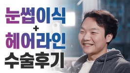 눈썹이식과 헤어라인교정을 함께한 모발이식 후기_모리의원 - kakaoTV 눈썹이식과 헤어라인교정을 함께한 모발이식 후기_모리의원