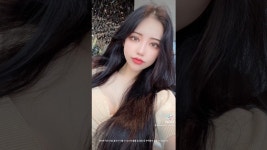 윤곽3종+절개눈매교정+앞트임+뒤밑트임+코재수술 절골 회복과정... 윤곽3종+절개눈매교정+앞트임+뒤밑트임+코재수술 절골 회복과정, 후기... 