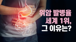 - 생명나눔한의원 명의 안소미 (강남,강남구청역,위암 치료) - kakaoTV 위암 발병 세계1위의 원인은? - 생명나눔한의원 명의 안소미 (강남... 