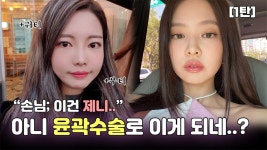 윤곽수술 하나로 제니 되기‼️수술 전후 대공개🎉[1탄] - kakaoTV 윤곽수술 하나로 제니 되기‼️수술 전후 대공개🎉[1탄]
