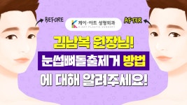 눈썹뼈돌출제거수술 케이아트성형외과 김남복 원장님의 설명! - kakaoTV 눈썹뼈돌출제거수술 케이아트성형외과 김남복 원장님의 설명!