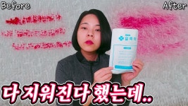 청춘세탁 얼룩약 솔직후기 - kakaoTV 청춘세탁 얼룩약 솔직후기