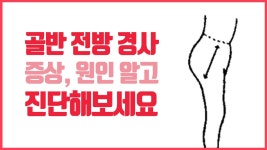 골반전방경사 증상, 원인 알고 진단해보세요 - kakaoTV 골반전방경사 증상, 원인 알고 진단해보세요