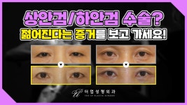 중년 눈성형 - 상안검/하안검수술 전후 사진 공개! 【눈성형잘하는곳 - 교대역 더업성형외과】 - kakaoTV 중년 눈성형 - 상안검/하안검수술 전후...