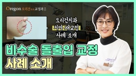 비수술 돌출입치아교정 전후 비교 [ 강남교정치과 - 오리건치과 ] - kakaoTV 비수술 돌출입치아교정 전후 비교 [ 강남교정치과 - 오리건치과 ]